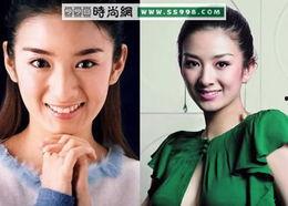 明星整形吃瓜爆料视频